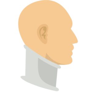 交通外傷/頸椎捻挫